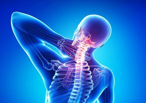 fájdalom a nyaki gerincben osteochondrosisral